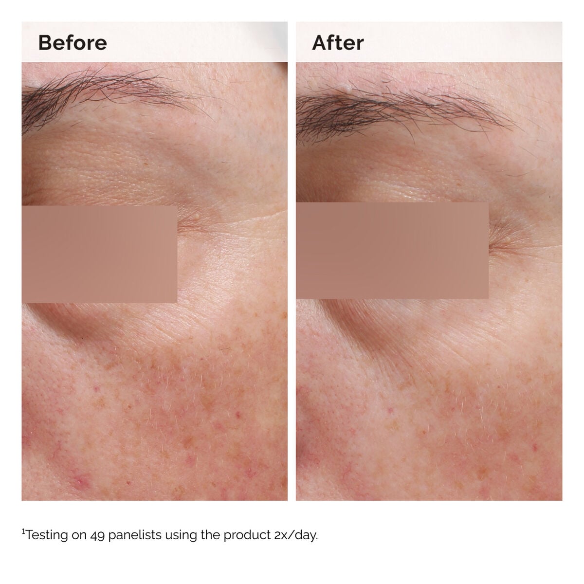 niacinamide-5-face-and-body-emulsion-d1 2024-08-23-ORD-Nia-5pct-Face-Body-B-A-Elasticity-Global-02-1x1.jpg