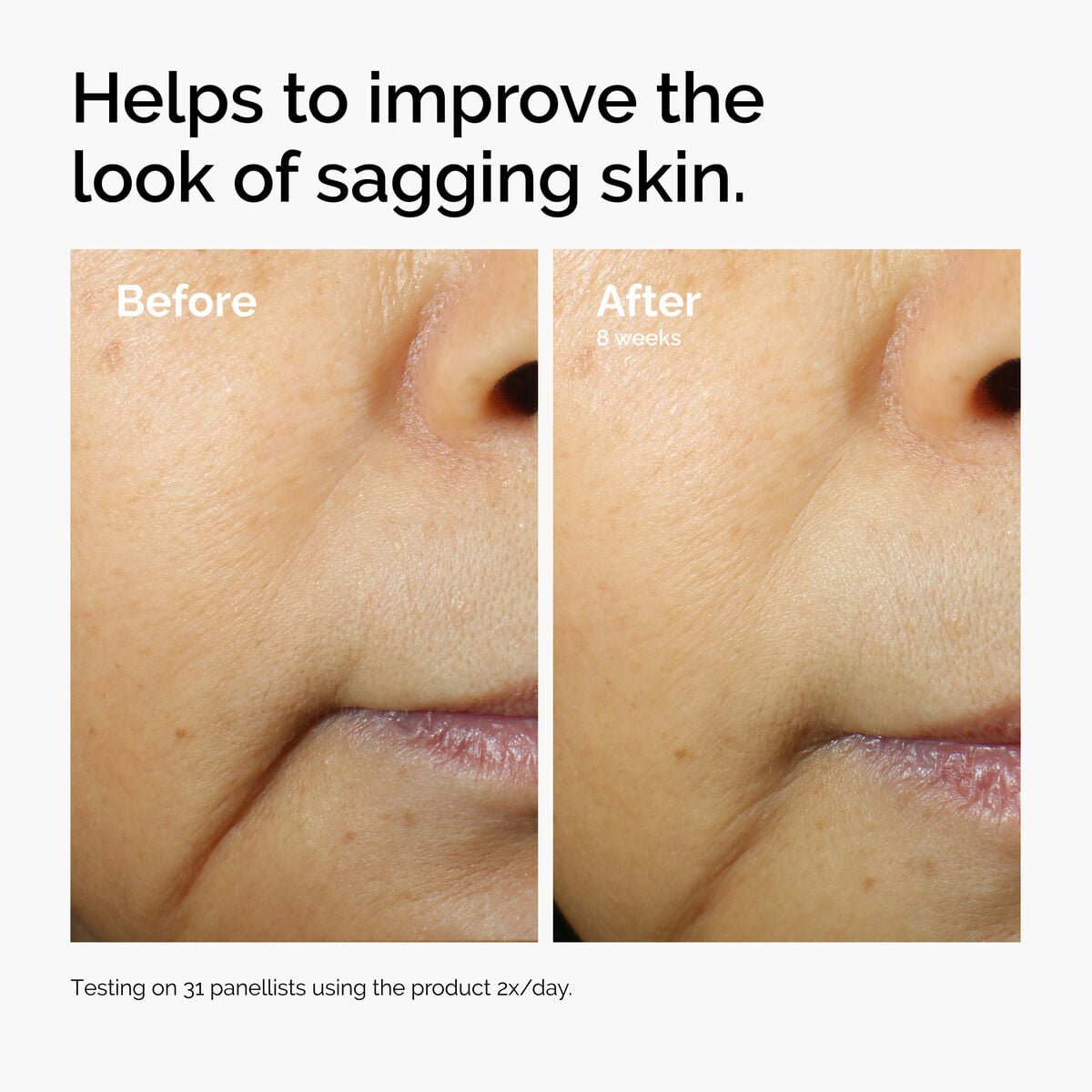 caffeine-3-escin-1-face-serum-a7 ord-caffeine-3pct-escin-1pct-face-serum-before-after-sagging.jpg