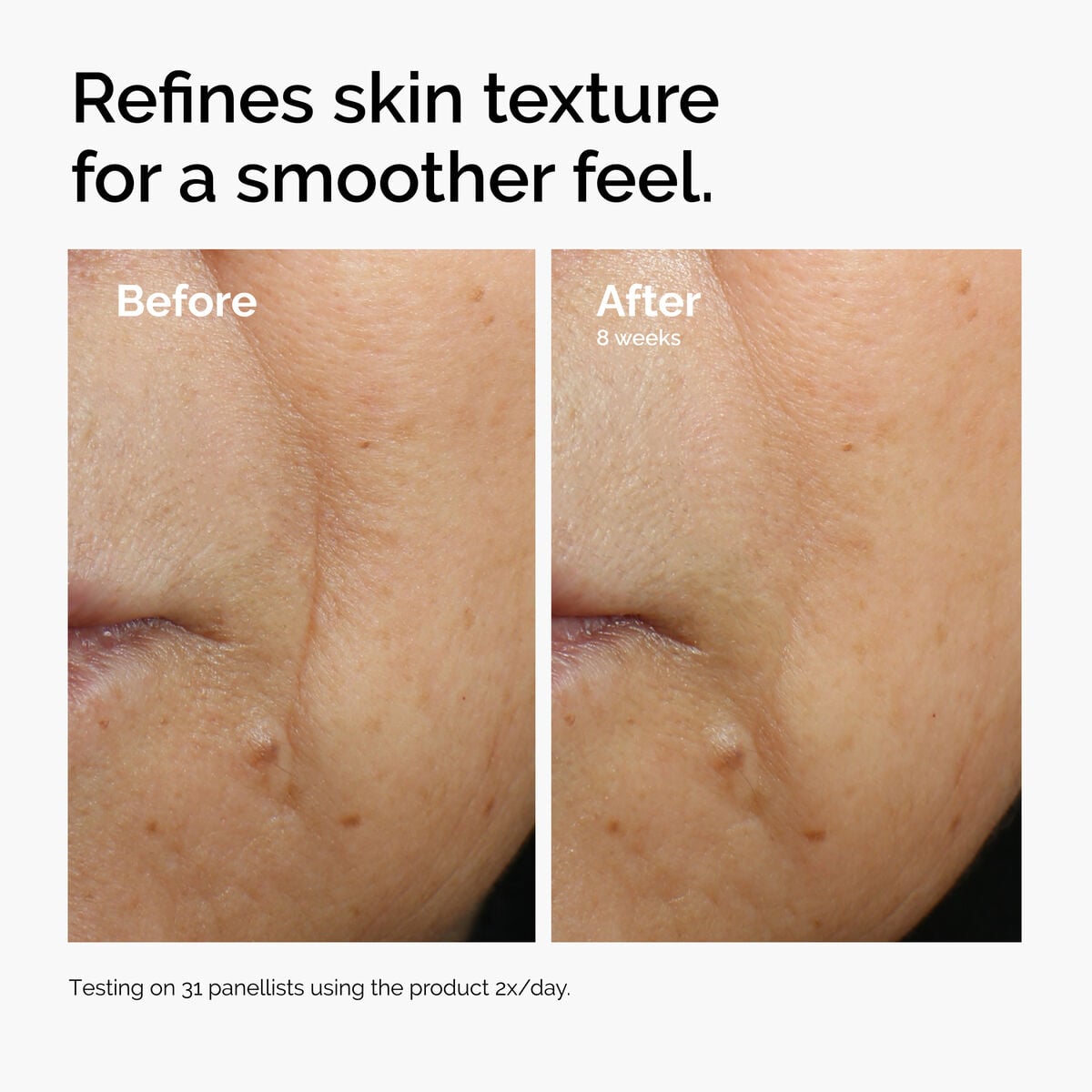caffeine-3-escin-1-face-serum-a7 ord-caffeine-3pct-escin-1pct-face-serum-before-after-texture.jpg
