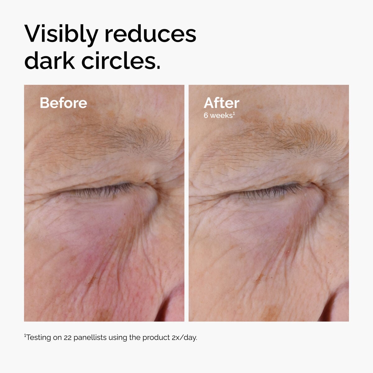 caffeine-solution-5-egcg-eye-serum-y4 ord-caffeine-solution-egcg-dark-circles-before-after.jpg