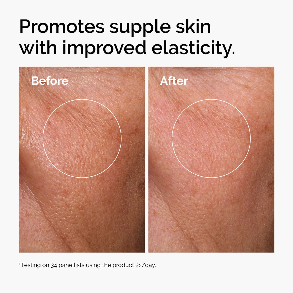 hyaluronic-acid-2-b5-with-ceramides-p9 ord-hyaluronic-acid-2pct-b5-hydrating-serum-before-after-elasticity.jpg