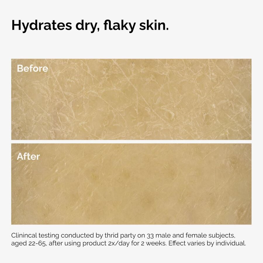 the-body-care-collection-b1 ord-natural-moisturizing-factors-inulin-body-before-after-graphic-02.jpg