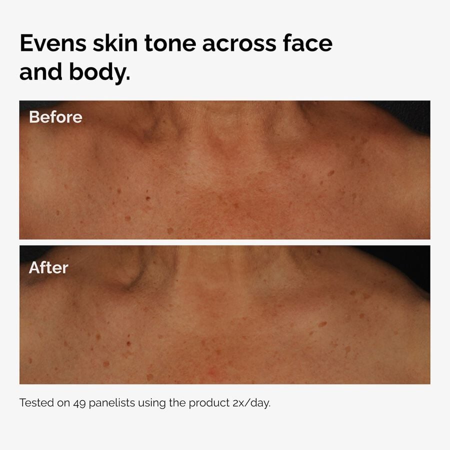 the-body-care-collection-b1 ord-niacinamide-face-body-serum-before-after-even-tone-graphic.jpg